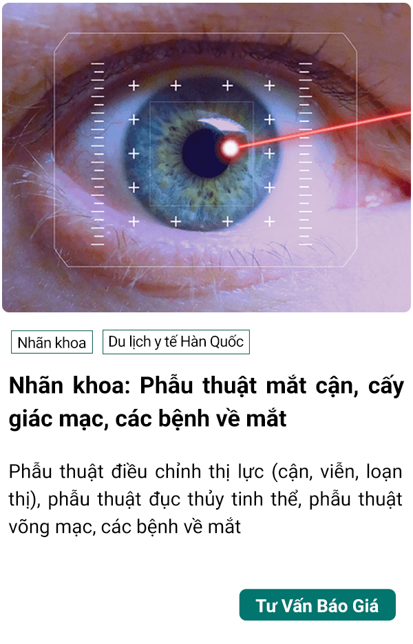 dich vu mo can thi, kham mắt tại hàn quốc